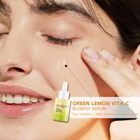 Tongyend Green Lemon Vitamin C Serum for Face, Blemish Serum, Dark Spot Correcting Glow Serum, Brighenting Face Serum for Hyperpigmentation, Fade Acne Marks, Improve Dullness, Shrink Pores, 30ml