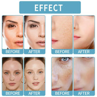 White Spot Cream,Herbal Freckle-Removing Cream,Lightening Cream for Face,Dark Spot Remover for Face,Dark Spot Corrector,Spot Cream,Freckle Removal Cream,Age Spot Remover for Face,Dark Spot Serum