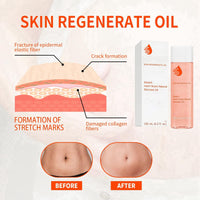HIVETZ 125ml Optimal Oil,Collagen Boost Firming Lifting Skincare Oil,Skin Regenerate Oil,Body Oil for Women,Stretch Mark Oil,Stretch Marks Removal,Body Skin Care Improves Appearance of Stretch Marks