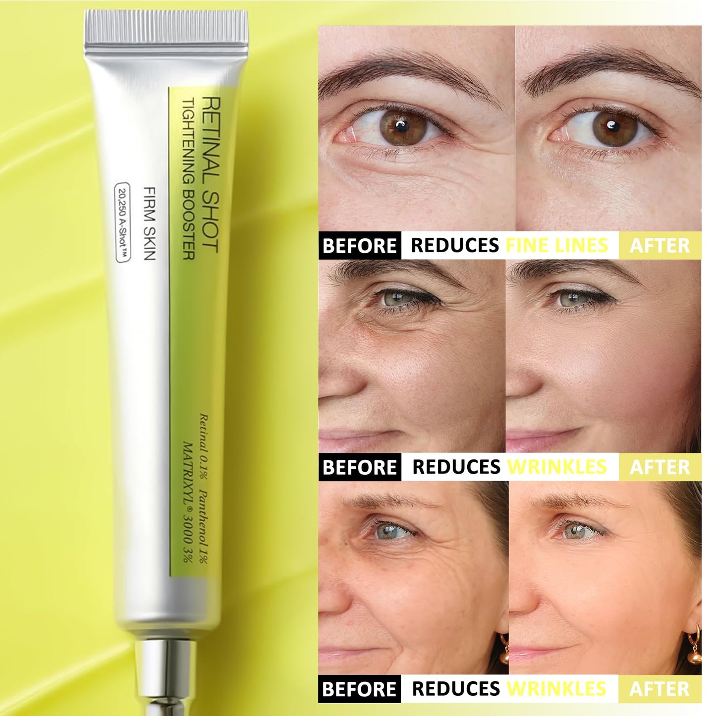 Shefave Vita A Retinal Shot Tightening Booster, Retinol Serum For Face, Anti Aging & Anti Wrinkle Serum | Pore Minimizer, Wrinkles & Fine Lines, Firmer Skin, Intense Hydration, 15ml (1 Pack)