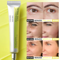 Shefave Vita A Retinal Shot Tightening Booster, Retinol Serum For Face, Anti Aging & Anti Wrinkle Serum | Pore Minimizer, Wrinkles & Fine Lines, Firmer Skin, Intense Hydration, 15ml (1 Pack)