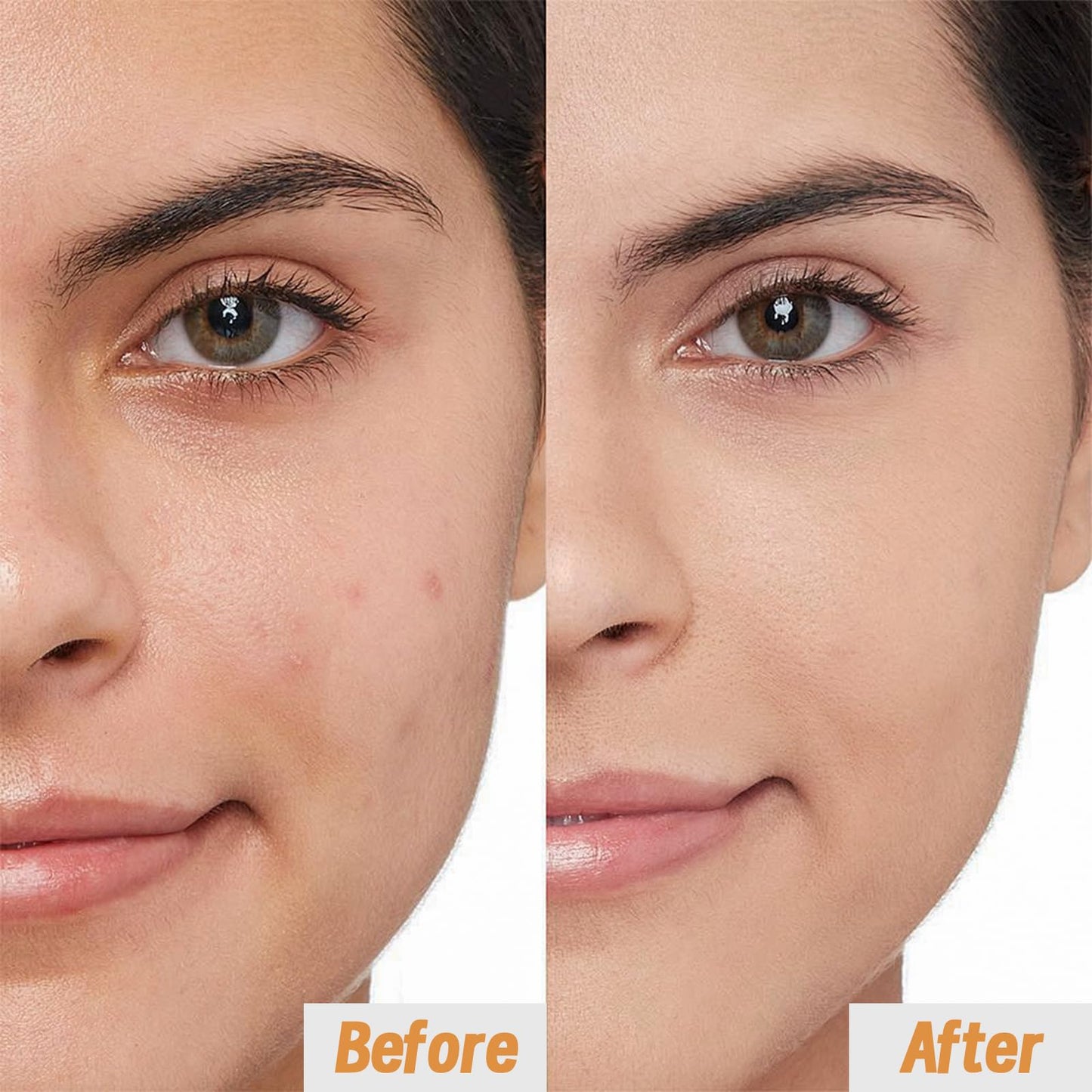 VGO Vitamin C Serum for Face, Facial Serum with Vitamin E & Hyaluronic Acid, Even Skin Tone, Anti-Dark Spots, Fine Lines & Wrinkle, 30ml