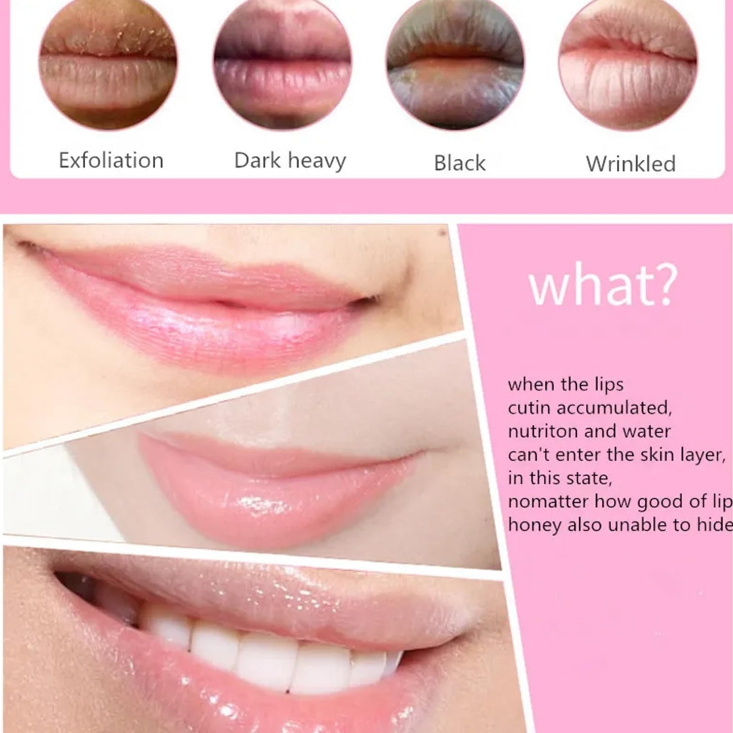 Mori Kamei 10pieces of collagen crystal lip mask nourish, moisturize, protect lips, resist aging, exfoliate skin, prevent chapped and dry skin and other problems