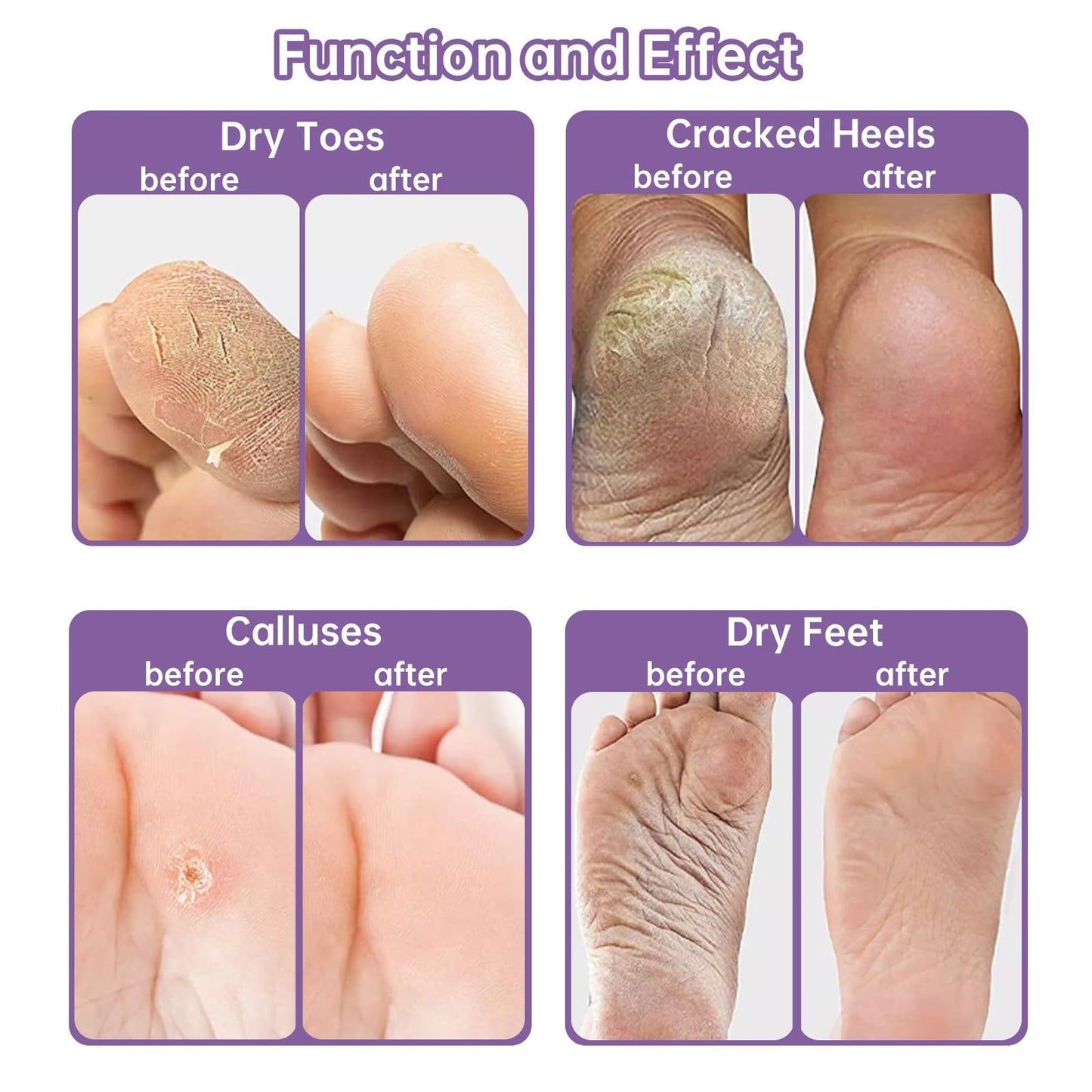 Generic 2 Pairs Foot Peel Mask for Hard Skin,Lavender Exfoliating Mask for Callus Remover Dead Dry Skin,Cracked Heel Treatment Socks, Plant Formula Moisturising Socks, Soft Foot Care