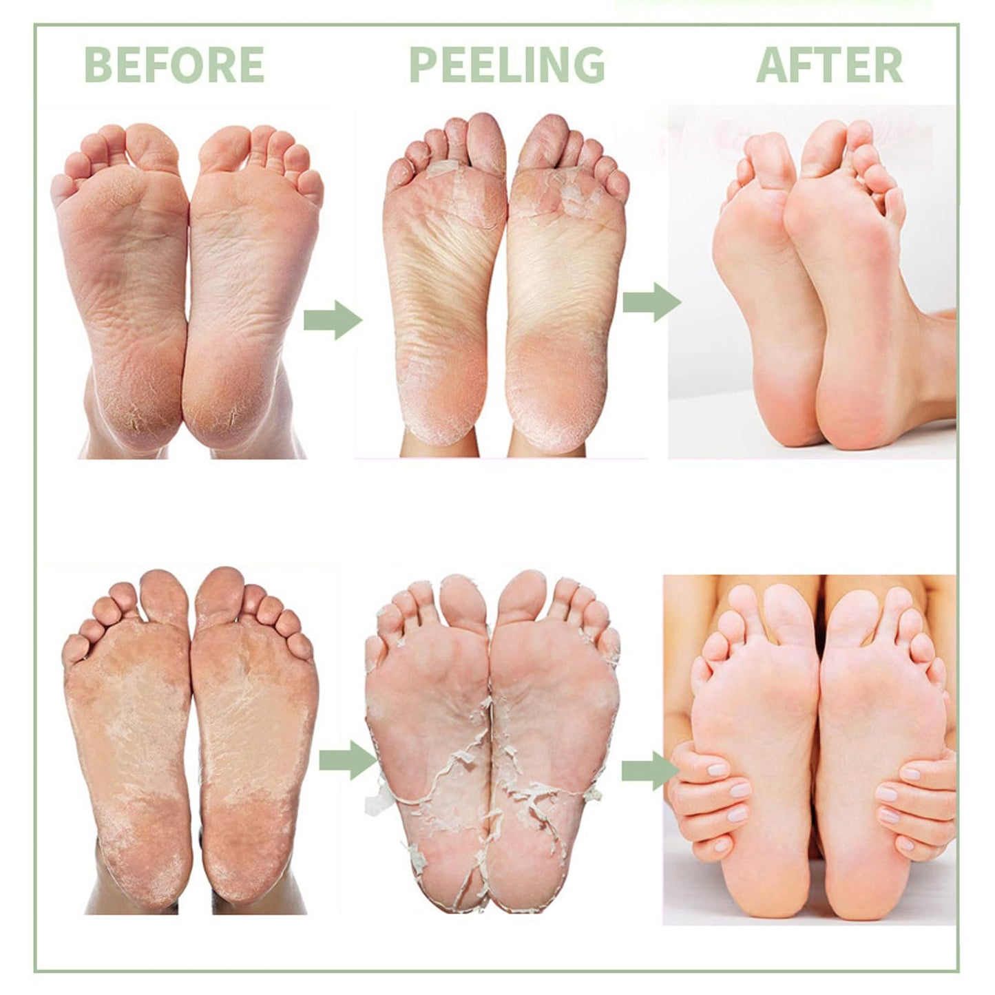 AuraAnge 4 PCS Aloe Vera Foot Peel Mask - Exfoliating Socks for Callus Removal - Cracked Heels, Dead & Dry Skin. Moisturizing for Soft, Smooth Feet