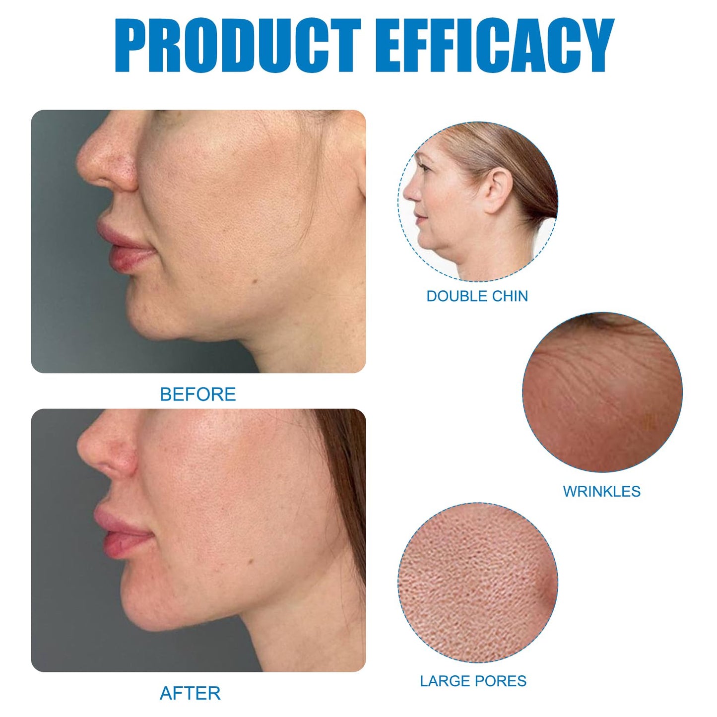 Bisienya 1 Piece Chinology Double Chin Lifting Mask Chin Mask Face Lifting Masks Nourishes the Skin, Tightens and Lifts the Face, Moisturizes and Hydrates, Creative Gift