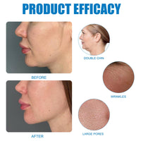 Bisienya 1 Piece Chinology Double Chin Lifting Mask Chin Mask Face Lifting Masks Nourishes the Skin, Tightens and Lifts the Face, Moisturizes and Hydrates, Creative Gift