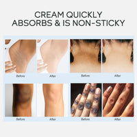 MrCuvaryas Face and Body Whitening Cream, Skin Lightening Cream for Dark Skin, Skin Bleaching Cream with Retinol for Acanthosis Nigricans, Hard Skin, Body Moisturiser Fade Melanin on Body Armpit Knees Elbows