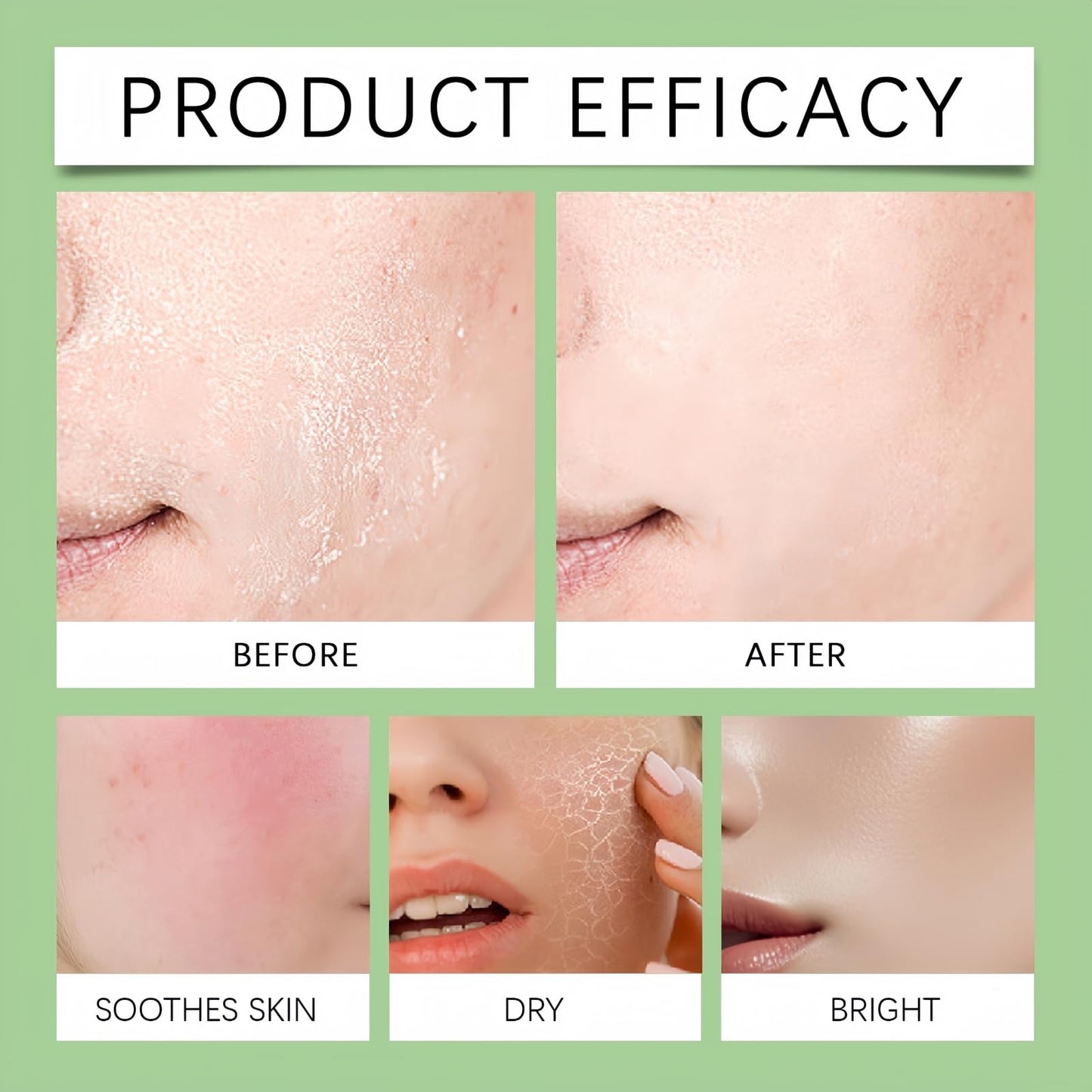 Fankayi Azelaic Acid 10 Hyaluron Redness Soothing Serum,Facial Serum for Sensitive Skin,Dark Spot Correcting Serum,Hyaluronic Acid Serum,Hyaluronic Acid Moisturiser,Gentle and Soothing,Light in Texture