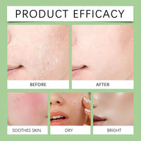 Fankayi Azelaic Acid 10 Hyaluron Redness Soothing Serum,Facial Serum for Sensitive Skin,Dark Spot Correcting Serum,Hyaluronic Acid Serum,Hyaluronic Acid Moisturiser,Gentle and Soothing,Light in Texture