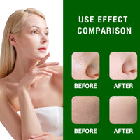 Bettinay Dark Spot Correcting Glow Serum, Dark Spot Remover for Face Pore Refining, Fades Acne Marks Pits