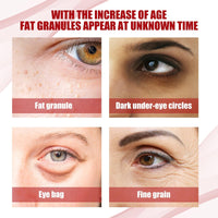 Fat Granules Removal Eye Serum,Anti-Aging & Anti-Wrinkles Under Eye Serum,Eye Ser-um for Dark Circles & Puffy Eyes,Tightening & Lifting Under Eye Serums,Dark Circle Eye Serums