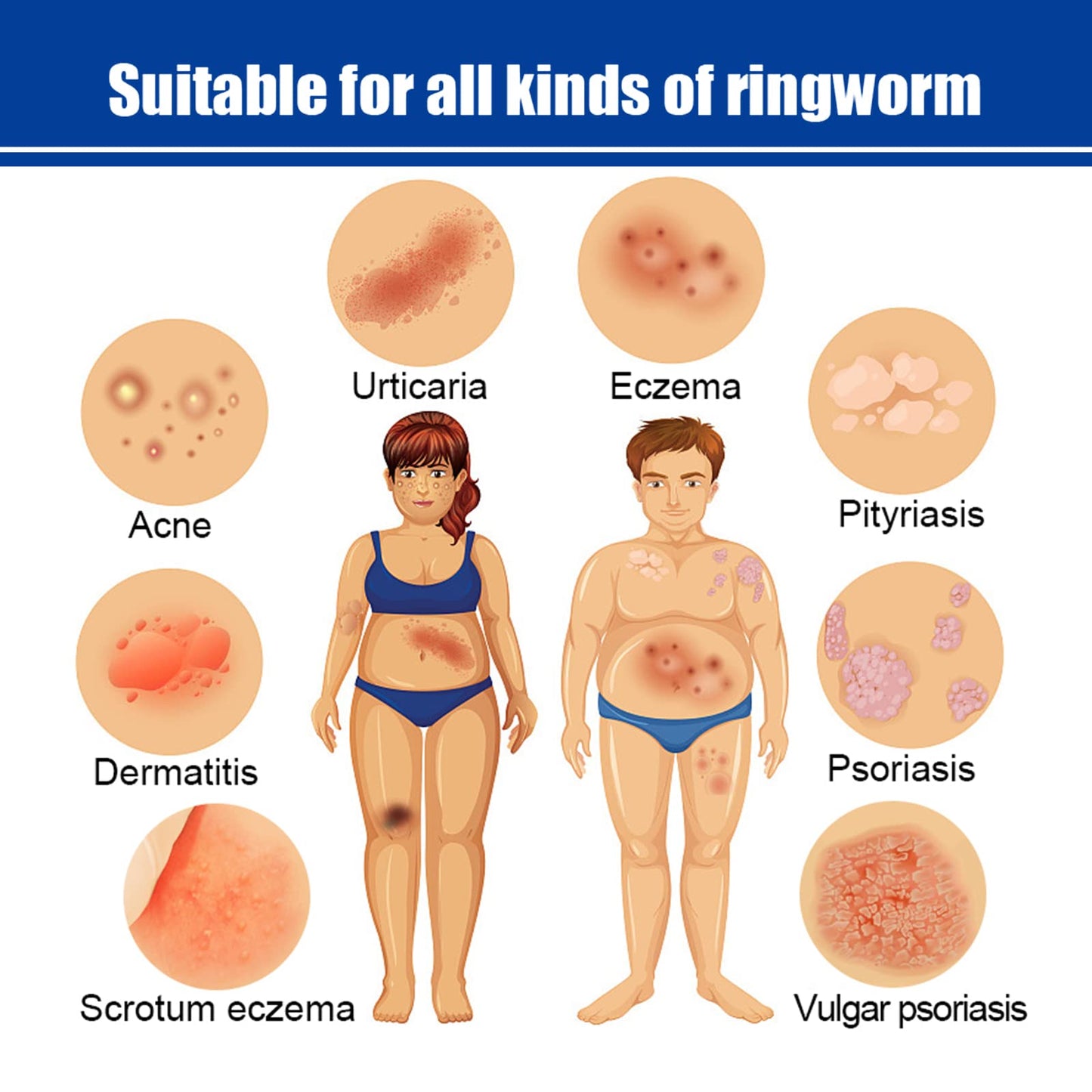 Herbal Skin Relief Cream with Aloe Vera – Soothing Moisturizer for Dry Skin – Lightweight, Non-Greasy Daily Hydration for All Types(2pcs) (2PCS)