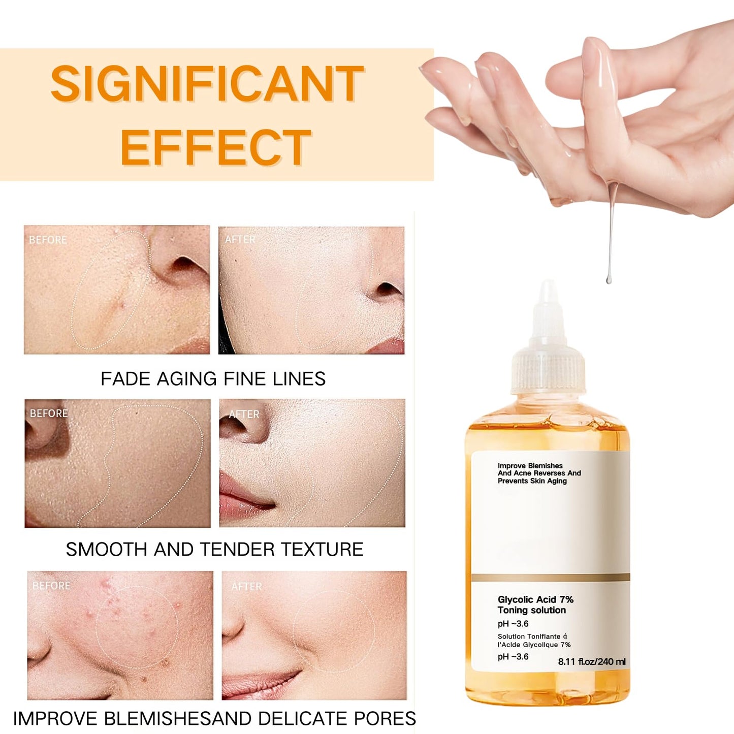 IZBEAUVO Glycolic Acid 7% Toning Solution,240ml Glycolic Acid Toning Resurfacing Solution,Glycolic Acid Serum, Hyaluronic Acid Serum for Blemishes And Acne,Refined Uniform Clean and Tender Toner Skincare