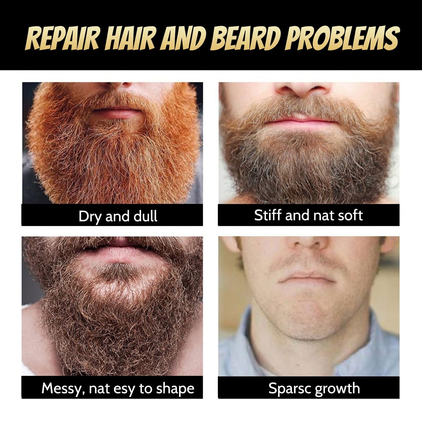 BloomBelle Beard Growth Serum with Derma Roller for Hair, Beard, Biotin Beard Growth Kit, Beard Roller, Rosemary Oil Beard Growth Oil, Rapid Growth & Thickening, Beard Grooming Kit For Men