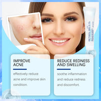 Retinol Gel,Retinol Acne Treatment Gel & Skin Soothing Cream,Retinol Moisturizer Cream,Spot Cre/am for Acne,Anti Acne G/el、