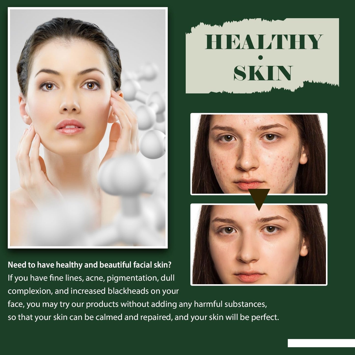 OuXing Spot Correcting Glow Serum,Hydrating & Brightening Serum,Spot Remover for Face,Skin Repairing Face Serum,Spot Treatment,Skin Lightening Cream,Freckle Removal Cre/am,Fa/ce Seru/m for Women,Sp/ot Cre/am