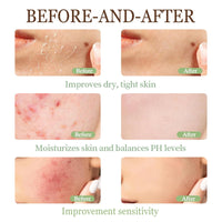 Wormeer Grass-Fed Beef Tallow Honey Balm for Skin - Nourishing Face & Body Cream for Dry Skin - Moisturizing Skincare with Mild Ingredients (Color, A)
