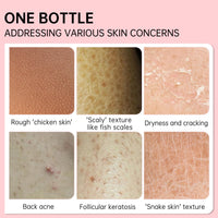 MEITREND Strawberry Skin Treatment,Skin Exfoliating Repair Cream with 20% Vitamin C and 25% Urea,Strawberry Legs Treatment Rough Bumpy Skin Body Lotion Moisturizing Cream,Chicken Skin Care Cream