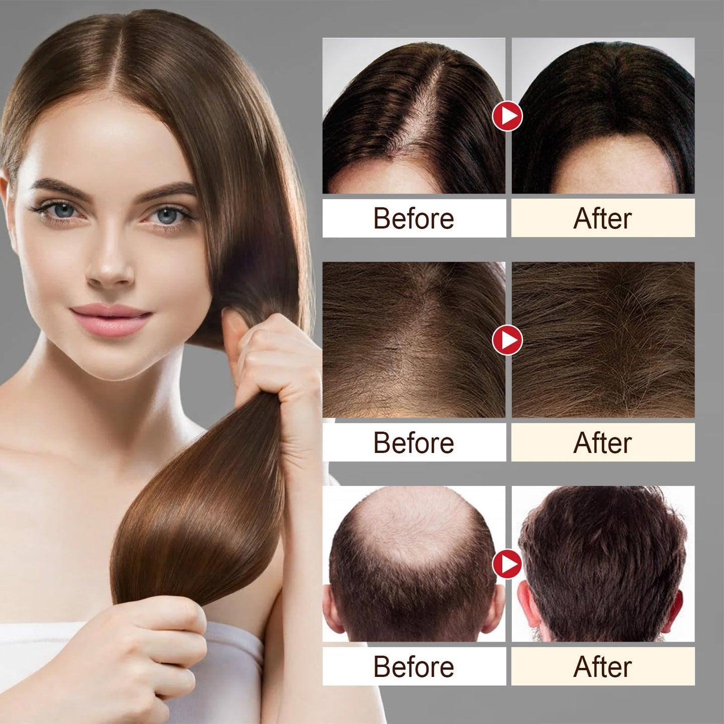 Oumun Deoxyribose Sugar Gel Hair Growth,Sugar Hair Growth Serums,Hair Serum for Hair Gro/wth,Hair Thickening Essence,Ha/ir Breakage Treatment,Ha/ir Oil for Dry Damaged Ha/ir,Deeply Nourish and Repair