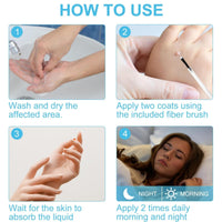 Yoowan Skin Ta/g Removal Serum,Fast-Acting & Painless Wa-Rt Remover,Wa-Rt Remover For Hands,Natural Plant Extract,Ta/g Dry&Fall Away Naturally Suitable For All Skin Types,Removal Of War-Ts On Back,Hands,Face