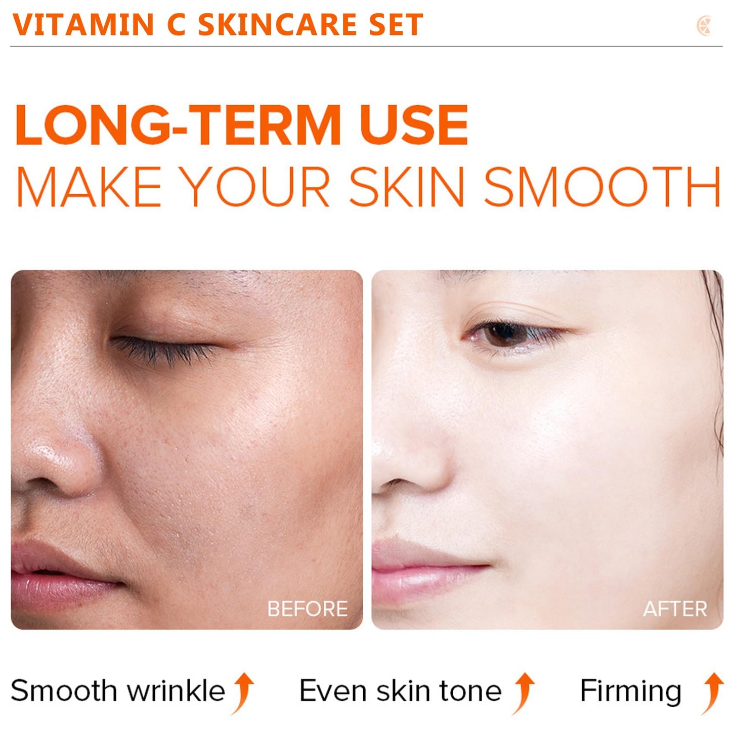 Vitamin C Skincare Set- Gifts For Teenage Girls & Women Vegan Beauty Gifs,Gift For Her,Birthday Gift Includes Face Serum, Eye Cream-Cleanser Toner Moisturiser Set For Anti-Aging-Improve Acne marks