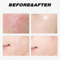 LaluluTek Grass-Fed Tallow Balm for Face & Body - Deeply Nourishing Moisturizer with Beef Tallow, Ideal for Dry Skin Care