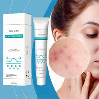 Xunzhi Acne Control Cream for Face,Acne Treatment Gel,A-cne Treatment,A-cne Face Cream,Ac-ne Gel Fast Absorbing Spot T-reatment,Anti Ac-ne F-ace C-ream,Acn-e C-ream for F-ace,Fa-ce Acn-e T-reatment