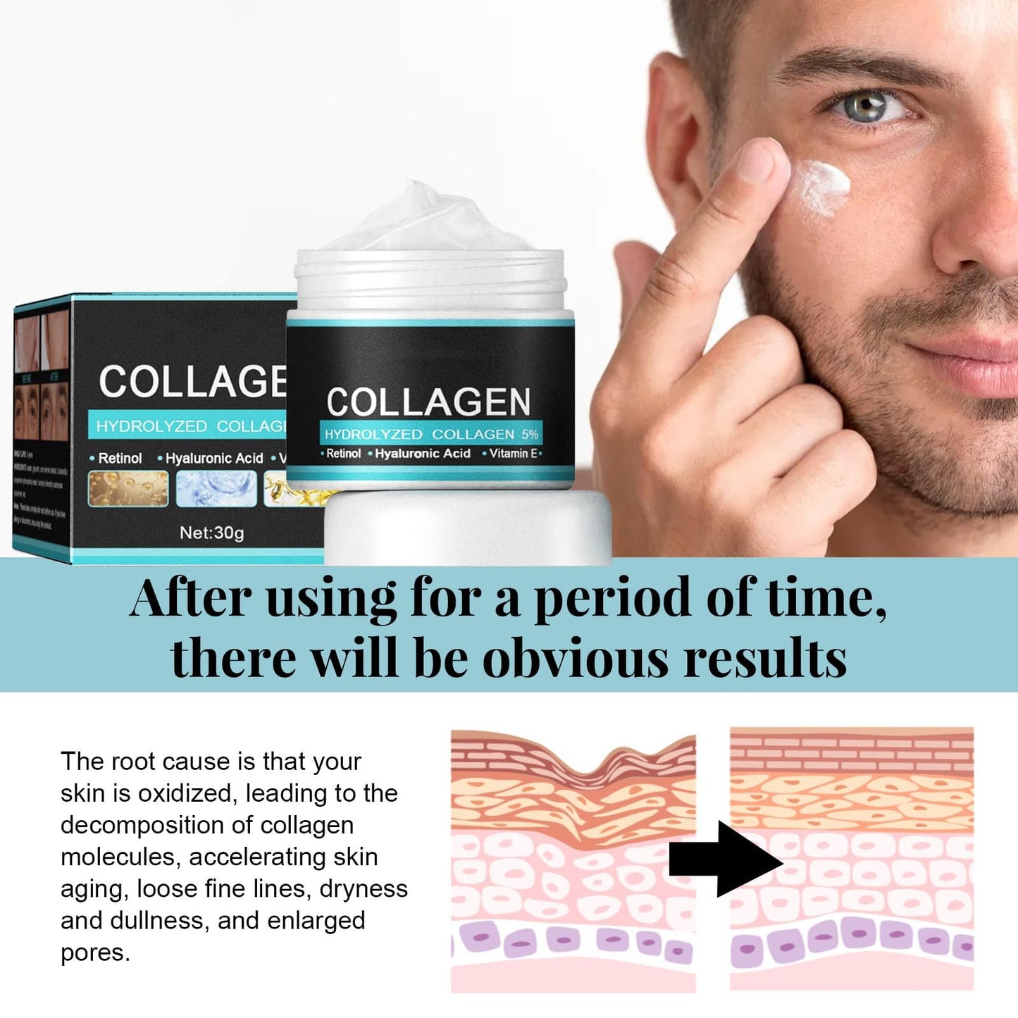 Yongst Men's Skin Tightening Face Cream - Moisturizer to Reduce Fine Lines and Wrinkles, Face Cream Moisturiser for Men, Anti Wrinkle Skincare for a Smoother, Youthful Appearance