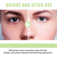 QinZiEn Zero Pore Pads,Dual-Textured Facial Toner Pads for Exfoliation and Minimizing Pores,Exfoliating Face Pads,Cotton Face Pads,Pore Pads,Exfoliating Pads,Exfoliating Pads Face,Makeup Pads,Cosmetic Pads