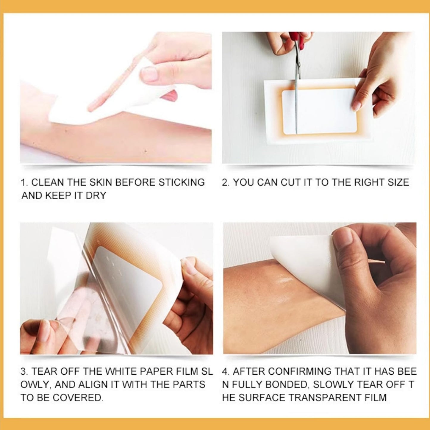 Siyinzu 6PCS Concealer Sticker,Invisible Scar Cover-Up,Breathable and Waterproof S-car Co-ver Stickers,Ultra Thin Patch for Scar,Concealer Stick-er for Covering Up Scars,Natural Con-cealer Stickers