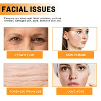 SingHao 2pcs Vitamina C Facial Serum,Anti Aging Face Serum with Vitamin C,Vitamin C Serum for Face,Anti Aging & Wrinkle Facial Seru/m for Women,Brightening Seru/m for Dark Spots,Skin Brightening Se/rum