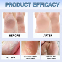 TBeautfave 3PCS Hand & Heel Cream for Very Dry Hands & Foot - Anti Crack Avocado Repair Stick - Urea Foot Cream- Cracked Heel Repair Cream, Hard Skin Remover, Dry Hand & Foot Moisturiser for Women & Men