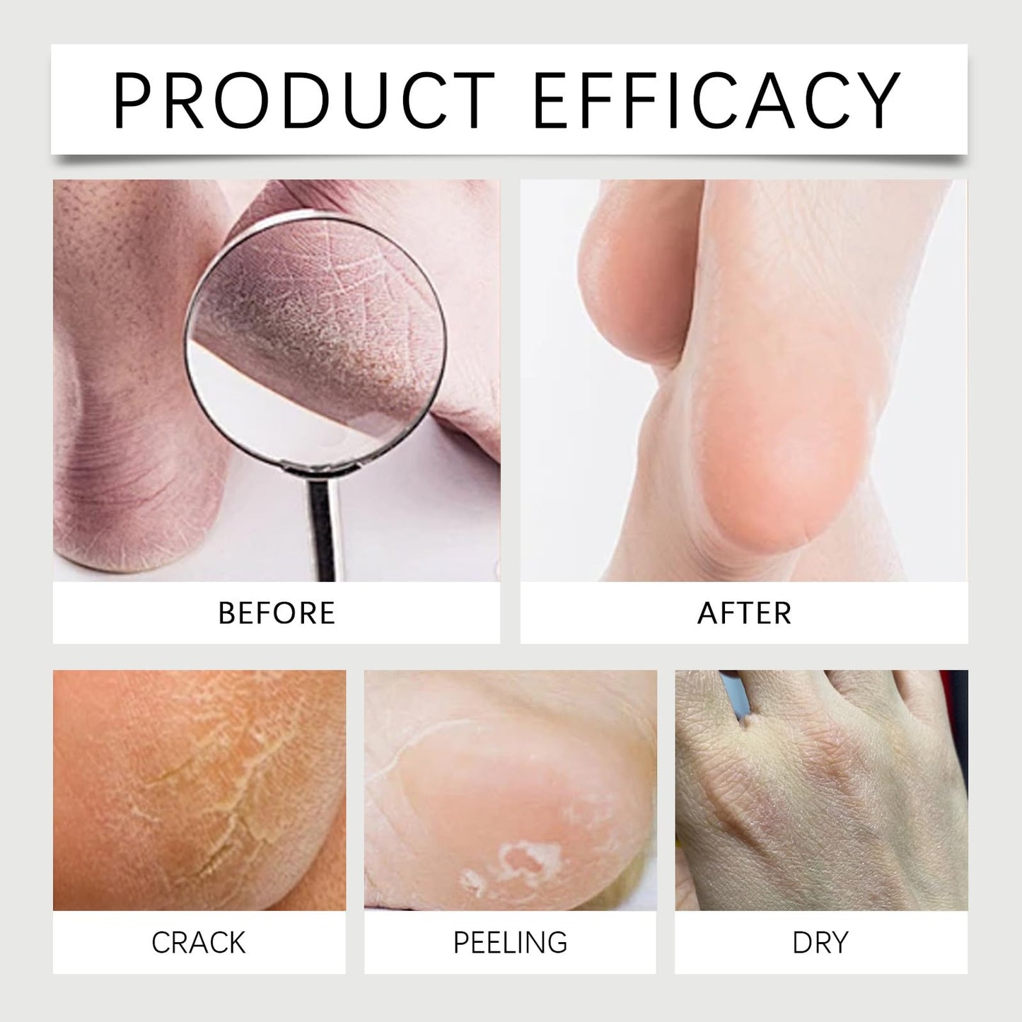 40% Urea Cracked Heel Balm, Deeply Moisturising Hand and Foot Cream Stick, 30g, 2-Pack