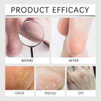 40% Urea Cracked Heel Balm, Deeply Moisturising Hand and Foot Cream Stick, 30g, 2-Pack