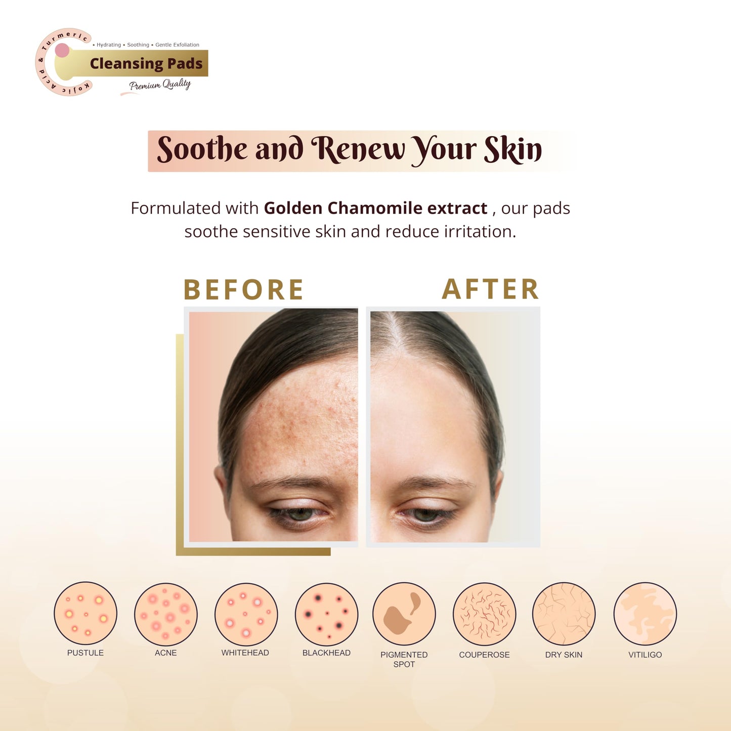 Kojic Acid And Turmeric Cleansing Pads, 55PCS, Turmeric Cleansing Pads for Dark Spots, Dark Spot Remover For Face, Turmeric Face Scrub Pads, Turmeric Kojic Acid Pads, Facial Cleanser for Turmeric Pads