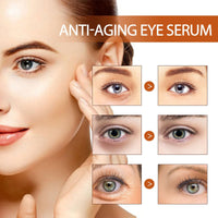 Jinjiar Lumi Eye Balm Cream,Lumi Eye Balm for Under Eye Bags,Erases Eye Bags within Minutes,Eye Ba-lm Bags Reducer,E-ye Cre-am Anti Aging,E-ye Cre-am for Dark Circles and Puffy E-yes,Under E-ye Cream