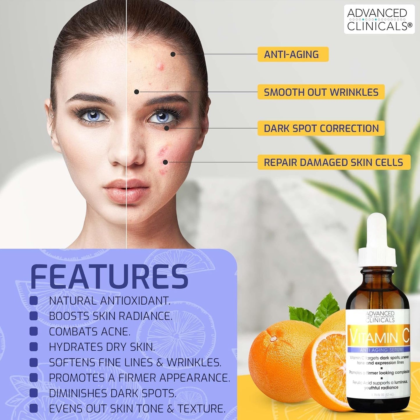Advanced Clinicals Brightening Vitamin C Face Serum Anti Aging Eye Serum | Potent Vitamin C Face Moisturizer Acne Facial Serum For Dark Spot Treatment, Wrinkle Repair, & Uneven Skin Tone, 1.75 Fl Oz