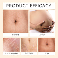 100g Belly Firming Cream,Skin Tightening Firming Body Cream,Skin Fi/rming Cre/am,Sk/in Tightening Body C/ream,B/ody Fir/ming Cre/am,Sk/in Tighte/ning Moisturizing,S/kin Smoothing Crea/m,Ski/n Cre/am