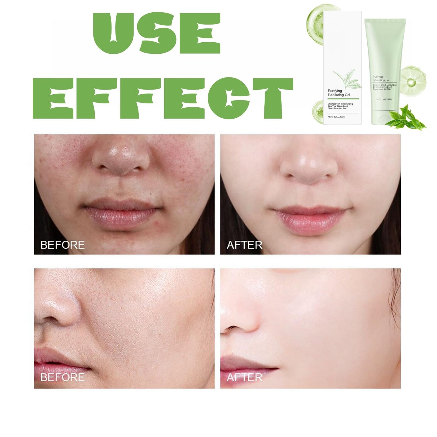 Oumun Purifying Exfoliating Gel,Face Exfoliating Scrub,Exfoliating Scrub Gel,Purifying Enzymes Exfoliating Gel,Face Scrub,Face Exfoliator,Exfoliating Face Wash,Face Scrub Exfoliator,Facial Scrub Exfoliator