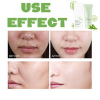 Oumun Purifying Exfoliating Gel,Face Exfoliating Scrub,Exfoliating Scrub Gel,Purifying Enzymes Exfoliating Gel,Face Scrub,Face Exfoliator,Exfoliating Face Wash,Face Scrub Exfoliator,Facial Scrub Exfoliator