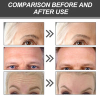 Aicocodida Forehead Wrinkle Patches 10pcs, Lavender Anti-Wrinkle Patches Smooth Fine Lines and Wrinkles with Collagen, Hyaluronic Acid, Pearl Extract(Lavender)