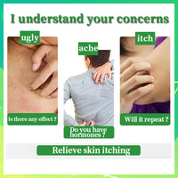 Athlete's foot Treatment cream - anti fungal foot cream for dry Feet, cracked heel Treatment & Athletes foot cream extra strong