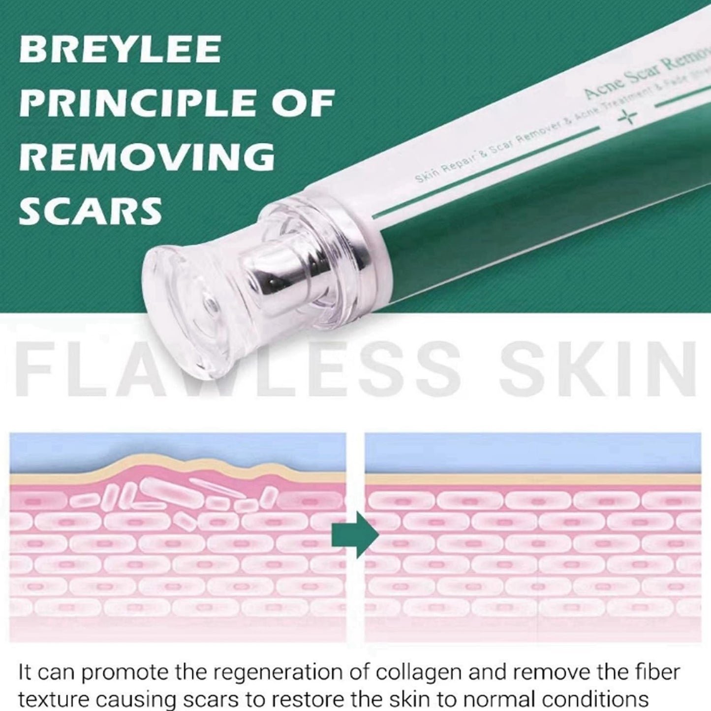 Shengqialun Herbal Scar Cream, Advanced Scar Treatment, Scar Healing Cream for Skin Repair, Scar Remover, Acne Treatment, Fade Stretch Marks, Scar Removal Cream Effective On Old & New Scars Face& Body