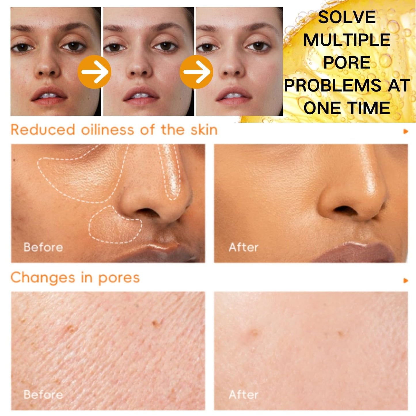 Cureluxe Vitamin C Eye Cream Stick - Vitamin V Serum Stick - Vitamin C Serum for Face Korean - Dark Spot Remover - Brightening Serums for Women - Reduce Fine Lines & Wrinkles