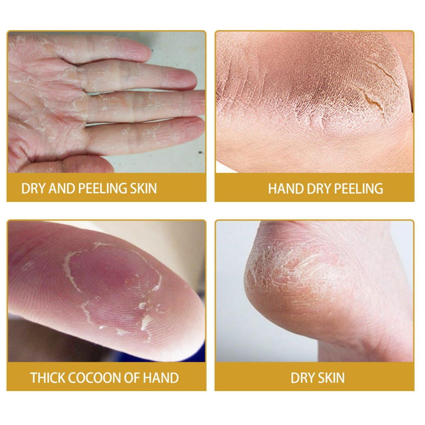 Honey Foot Cream,Hand & Foot Cream for Very Dry Feet & Hands,Cracked Heel Repair Cream,Foot Mask,Foot Moisturiser,Hard Skin Remover,He/el Balm for Cracked H/eel,Feet Cream,F/oot Balm