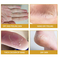 Honey Foot Cream,Hand & Foot Cream for Very Dry Feet & Hands,Cracked Heel Repair Cream,Foot Mask,Foot Moisturiser,Hard Skin Remover,He/el Balm for Cracked H/eel,Feet Cream,F/oot Balm