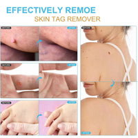 Yoowan Skin Ta/g Removal Serum,Fast-Acting & Painless Wa-Rt Remover,Wa-Rt Remover For Hands,Natural Plant Extract,Ta/g Dry&Fall Away Naturally Suitable For All Skin Types,Removal Of War-Ts On Back,Hands,Face