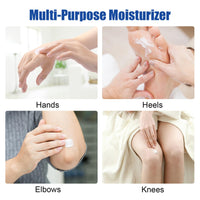 ChicNana 60% Urea Cream,Urea Foot Cream,Foot Cream for Cracked Heels and Dry Skin Athletes Foot Cream Cracked Heel Repair Cream Cracked Heel Repair Cream for Feet and Hand 150g