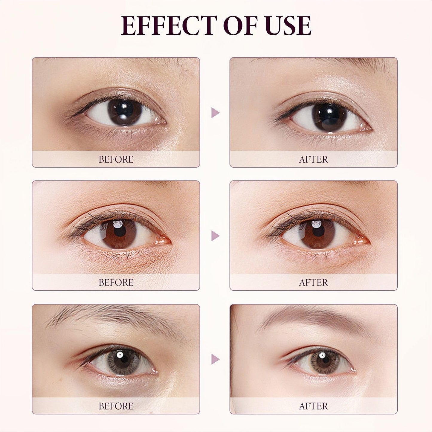 Eyelift Serum Mango Revitalize Eye Cream,Mango Activating And Firming Eye Cream,Hyaluronic Acid Repair Cream,Dark Circle Ey-e Crea-m,Ey-e Cream for Dark Circles,Eye Crea-m for Puffy Eyes,Ey-e Bag